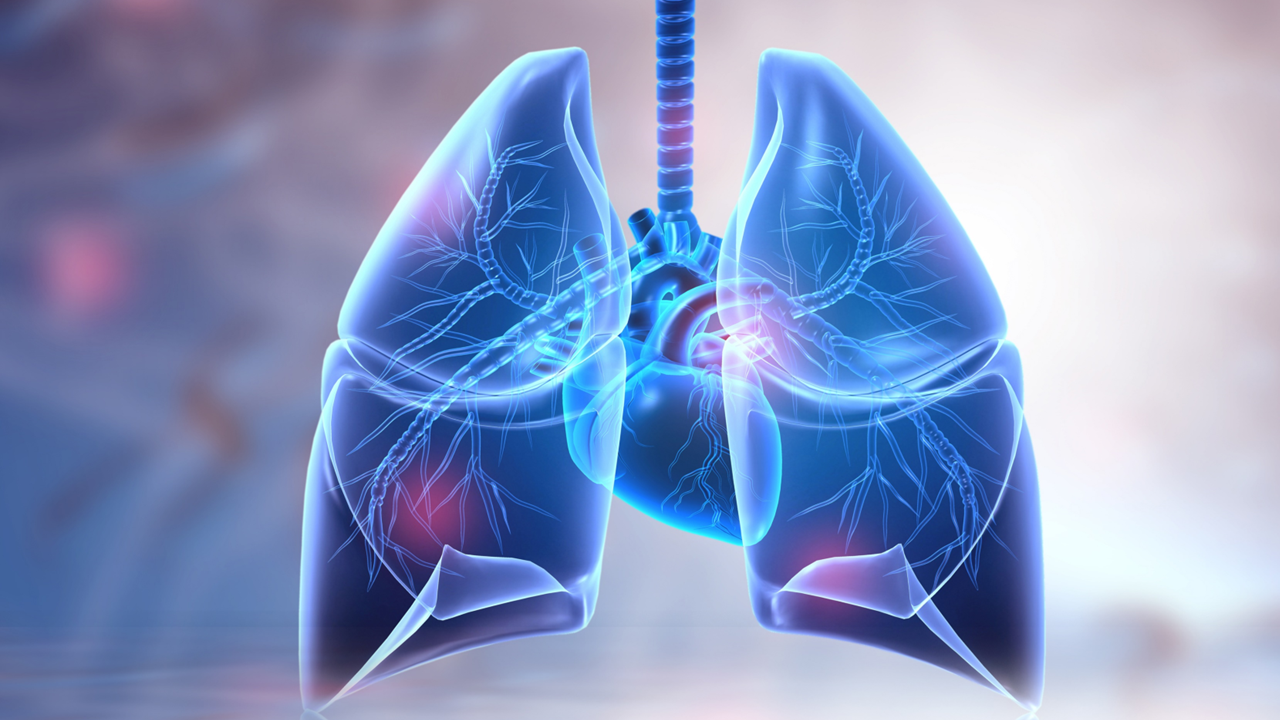 CPCNP metastásico: pembrolizumab subcutáneo en combinación con ALT-B4 y QT cumplieron con sus objetivos primarios, estudio MK-3475A-D77
