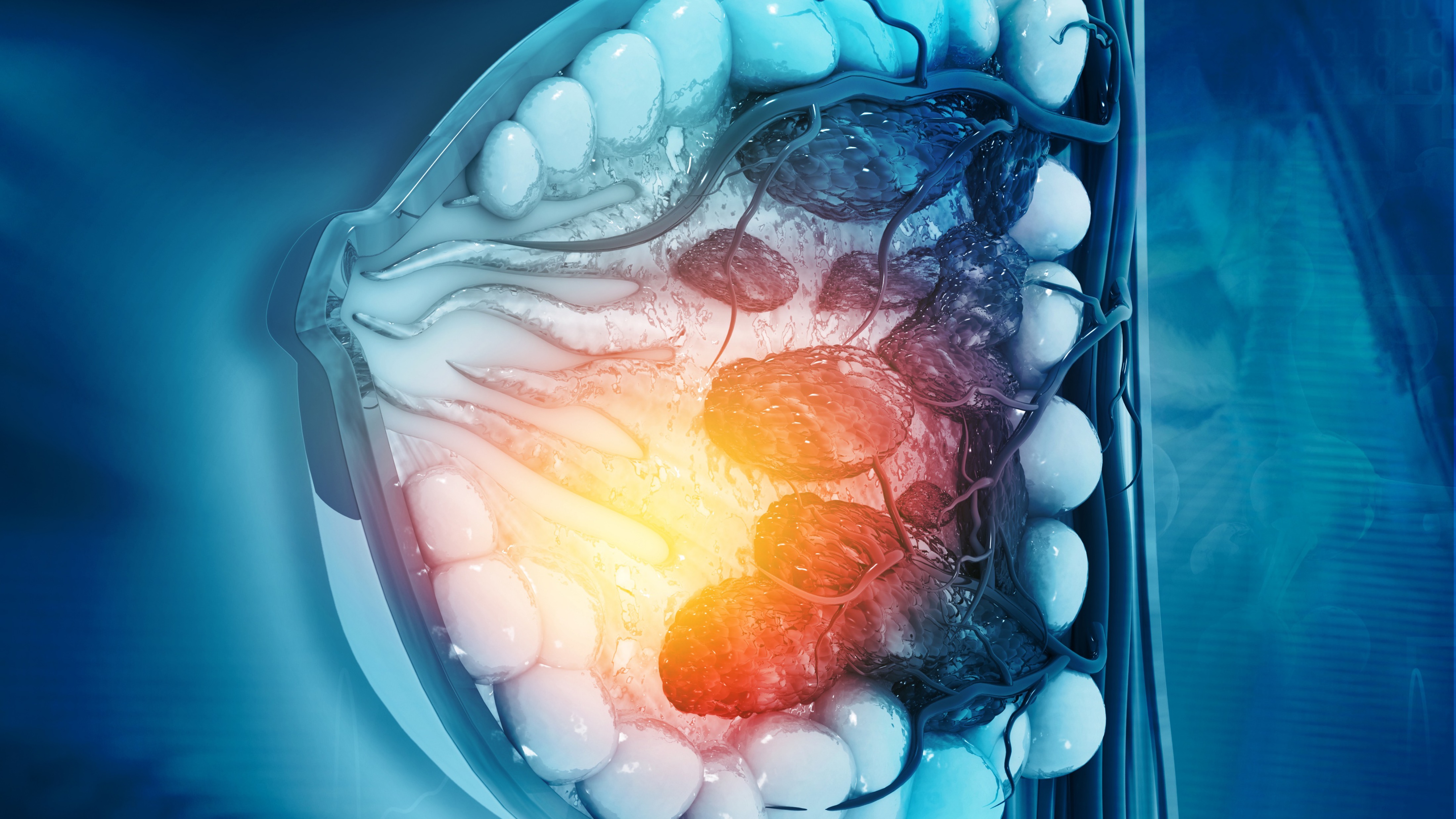Cá. mama avanzado: resultados del estudio postMONARCH con abemaciclib + fulvestrant tras progresión con iCDK4/6