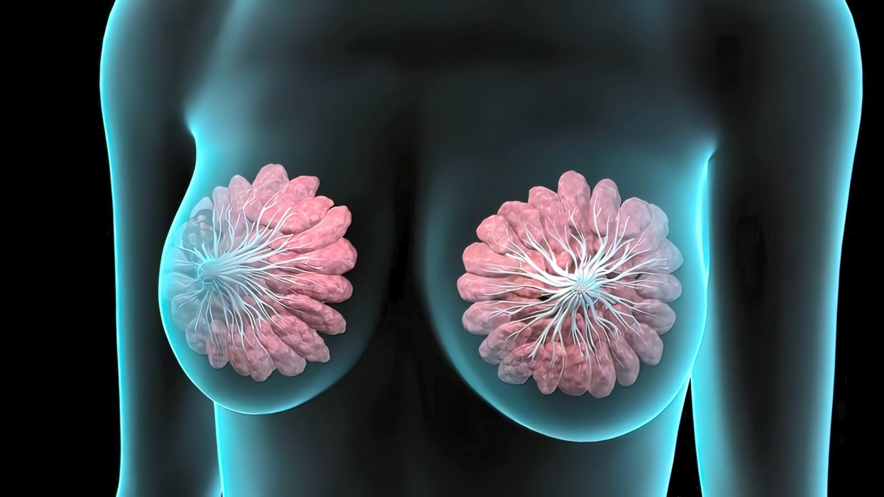 Cáncer de mama avanzado PIK3CA mutado, RH+ y HER2- en 1L: inavolisib + palbociclib + fulvestrant mejoran la SG, estudio INAVO120