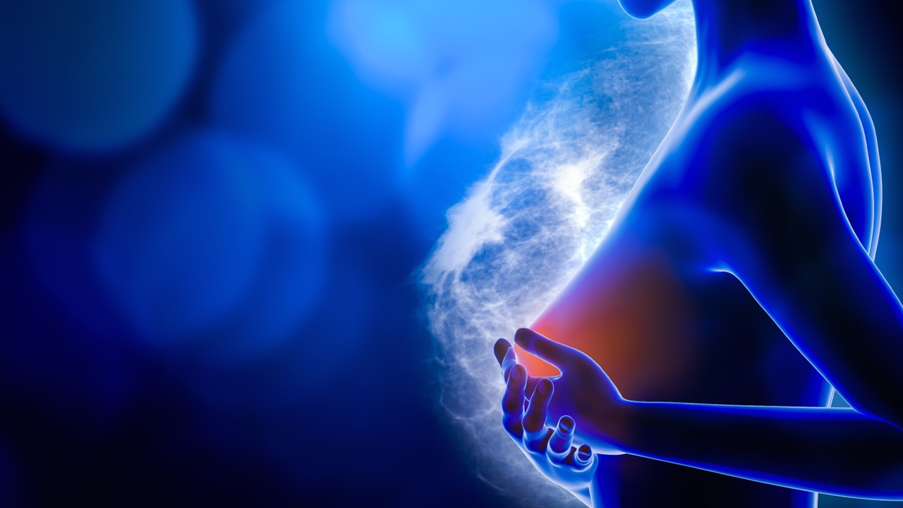 CMm RH +, HER2-bajo o HER2-ultrabajo: FDA aprobó T-DXd en pacientes luego de la progresión de la enfermedad tras una o más terapias endocrinas, estudio DESTINY-Breast06