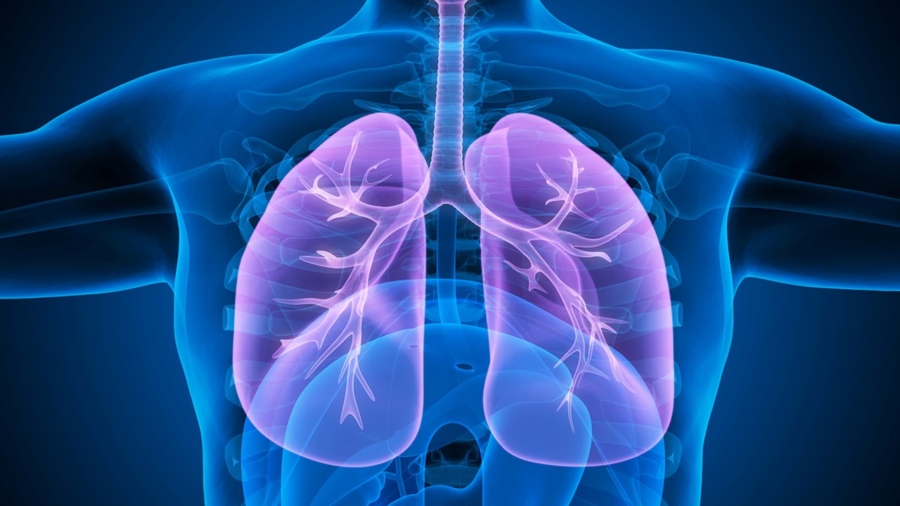 CPCNP localmente avanzado o metastásico: amivantamab + lazertinib mostraron una mejora en la SG en pacientes con mutaciones de ex19del o sustituciones L858R en el EGFR, estudio MARIPOSA