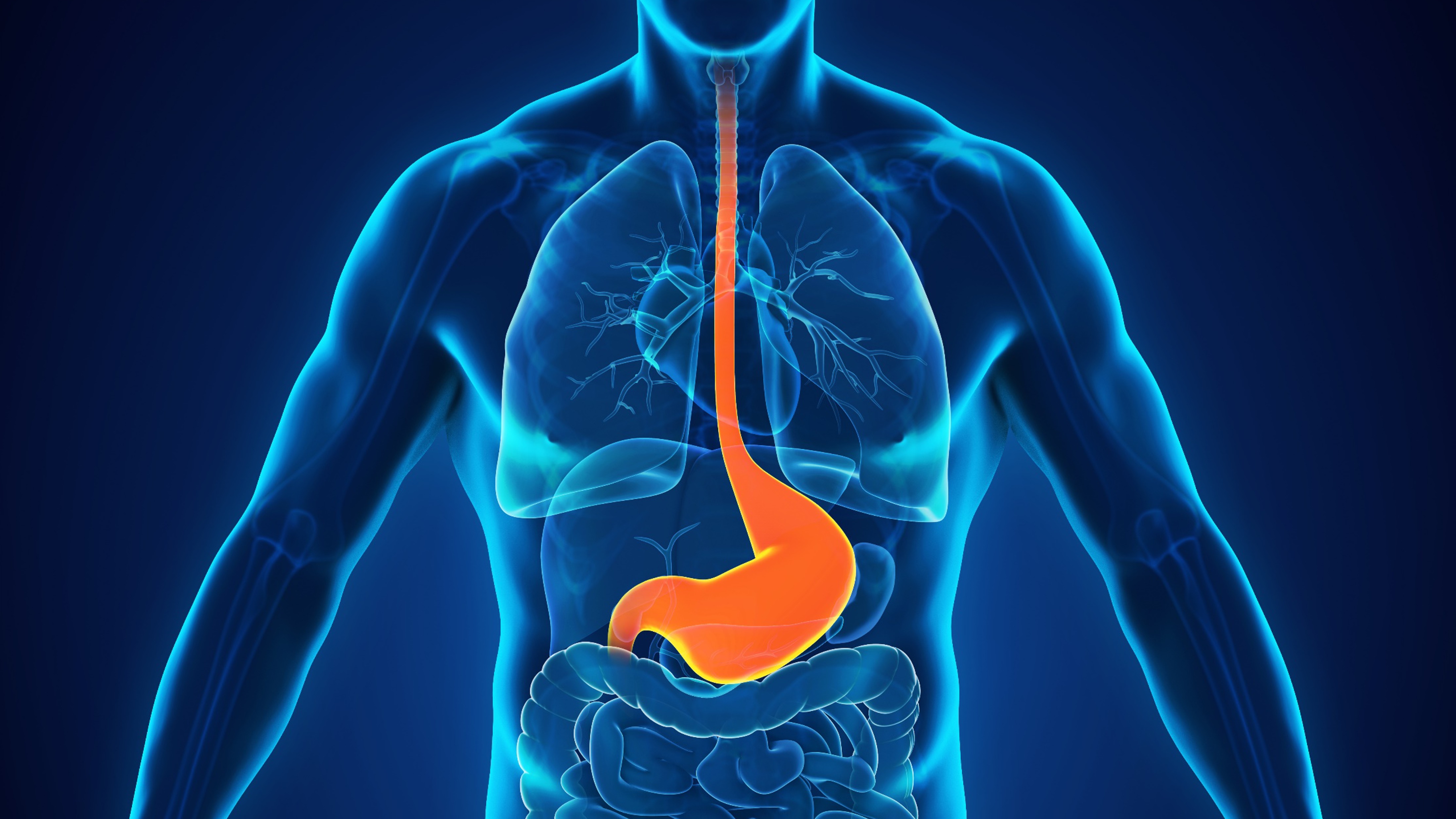 Cáncer gástrico o de la unión gastroesofágica HER2-positivo metastásico: trastuzumab deruxtecan mejora la SG, estudio DESTINY-Gastric04