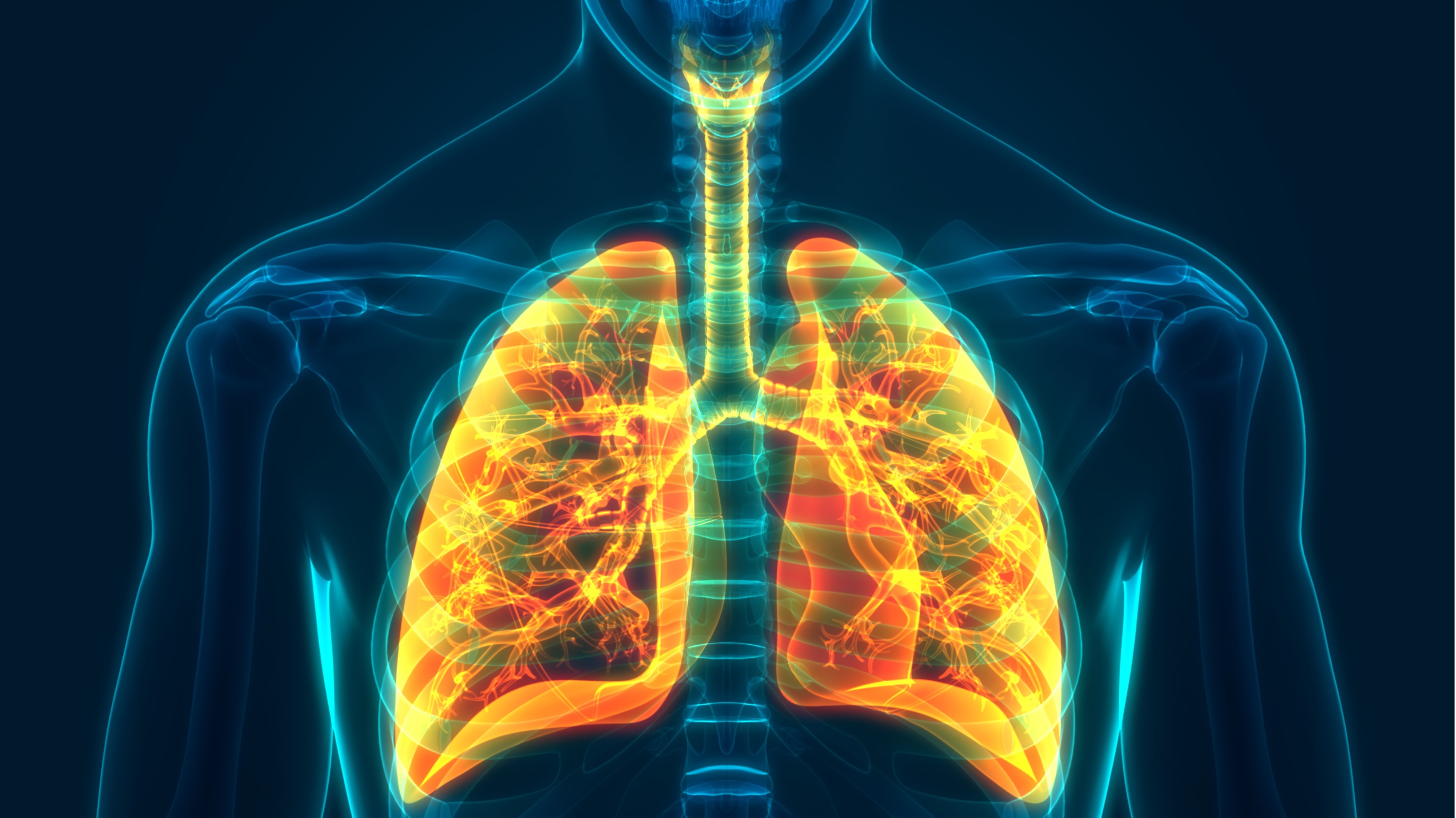 CPCNP metastásico: resultados de pembrolizumab subcutáneo frente al intravenoso, estudio 3475A-D77