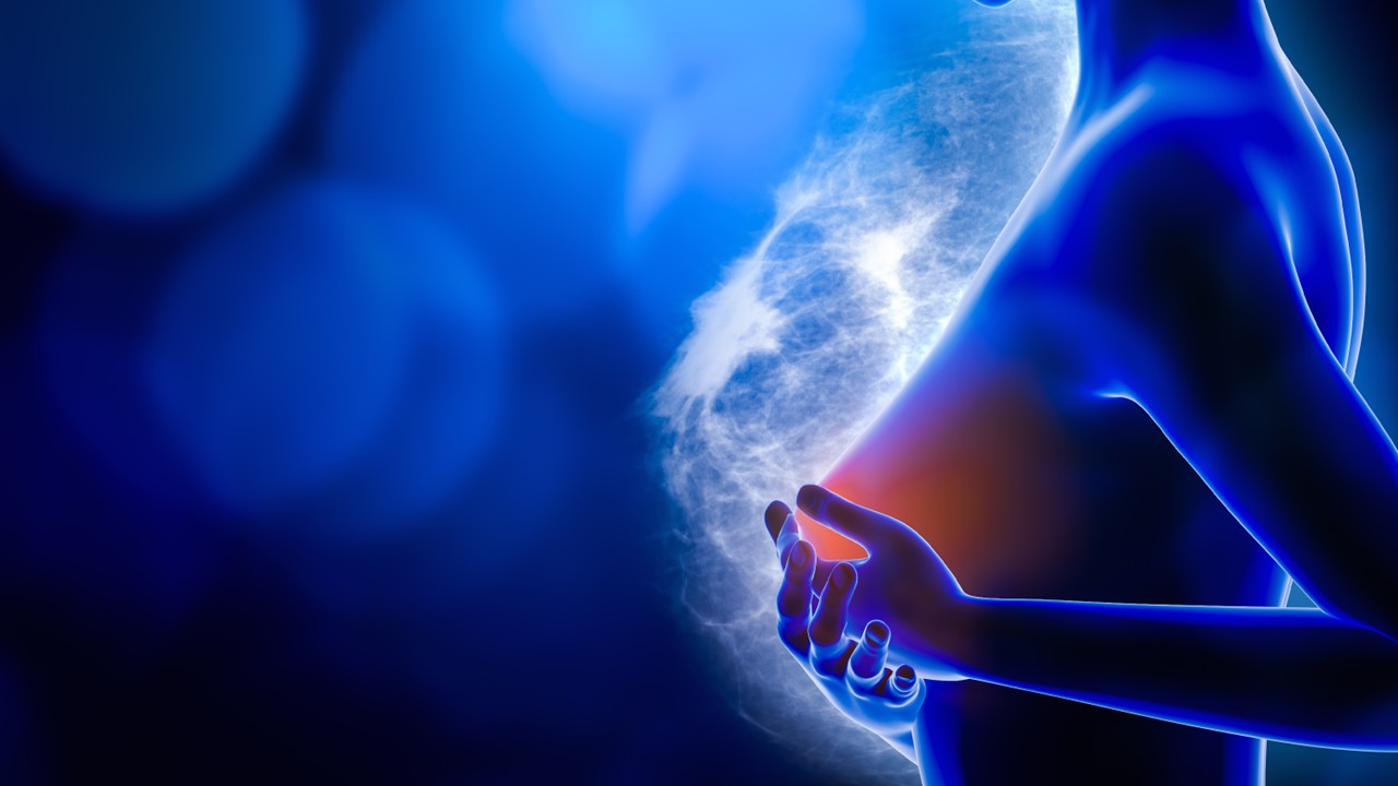 CMTN localmente avanzado, irresecable o metastásico: sacituzumab govitecan más pembrolizumab mejoraron significativamente la SLP en pacientes con expresión de PD-L1 positivo, estudio ASCENT-04/KEYNOTE-D19