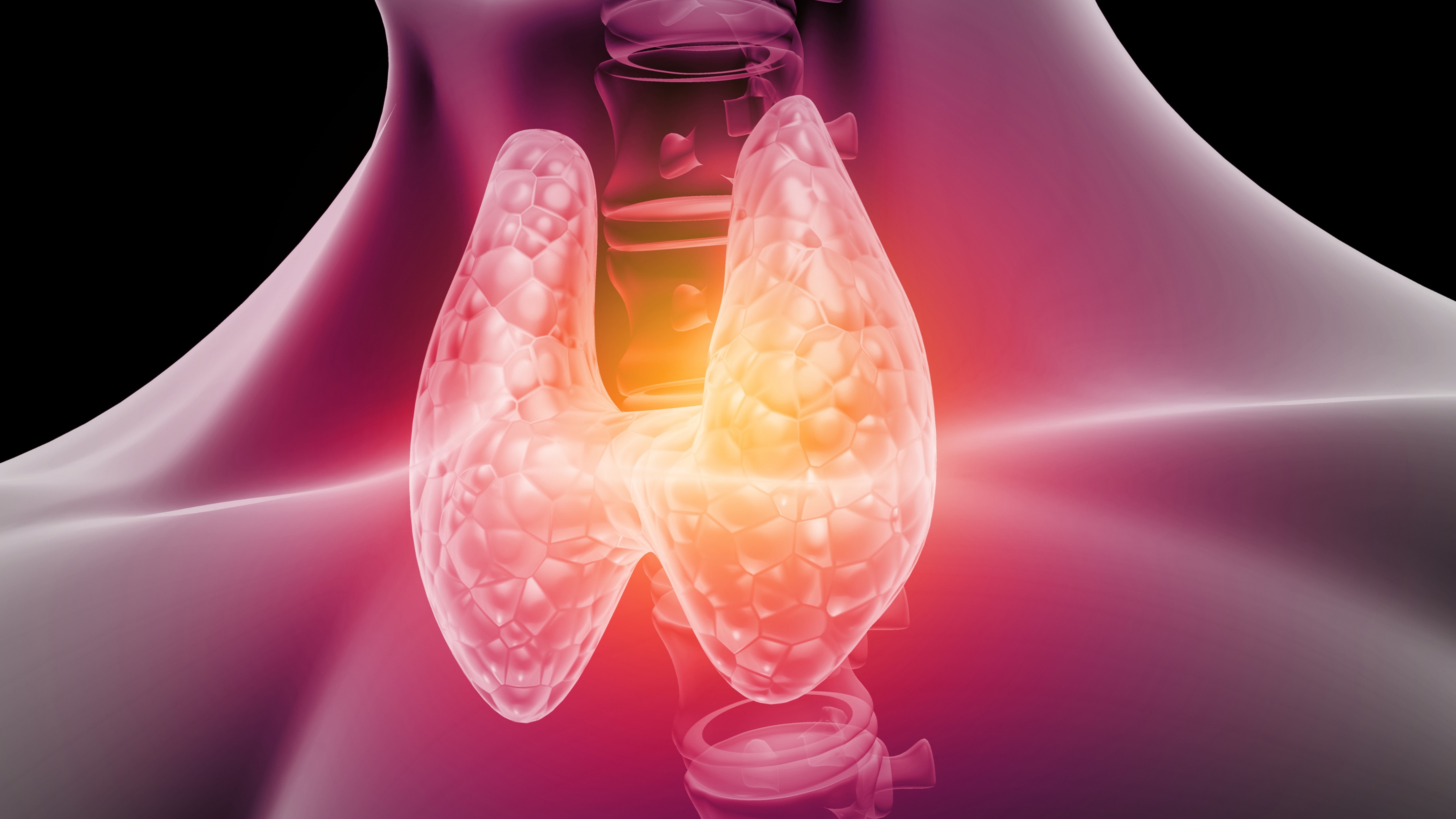 Cáncer diferenciado de tiroides: omisión segura de ablación, estudio IoN