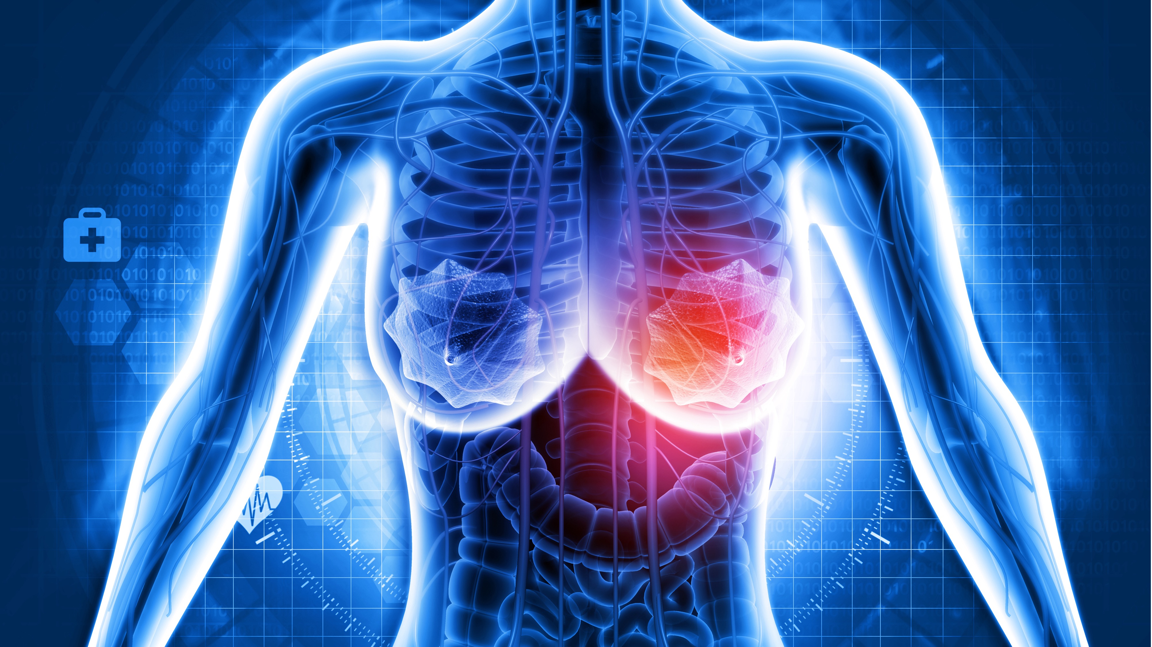 Cáncer de mama avanzado RH+/HER2-negativo PIK3CA wt: gedatolisib mejora significativamente la SLP, estudio VIKTORIA-1