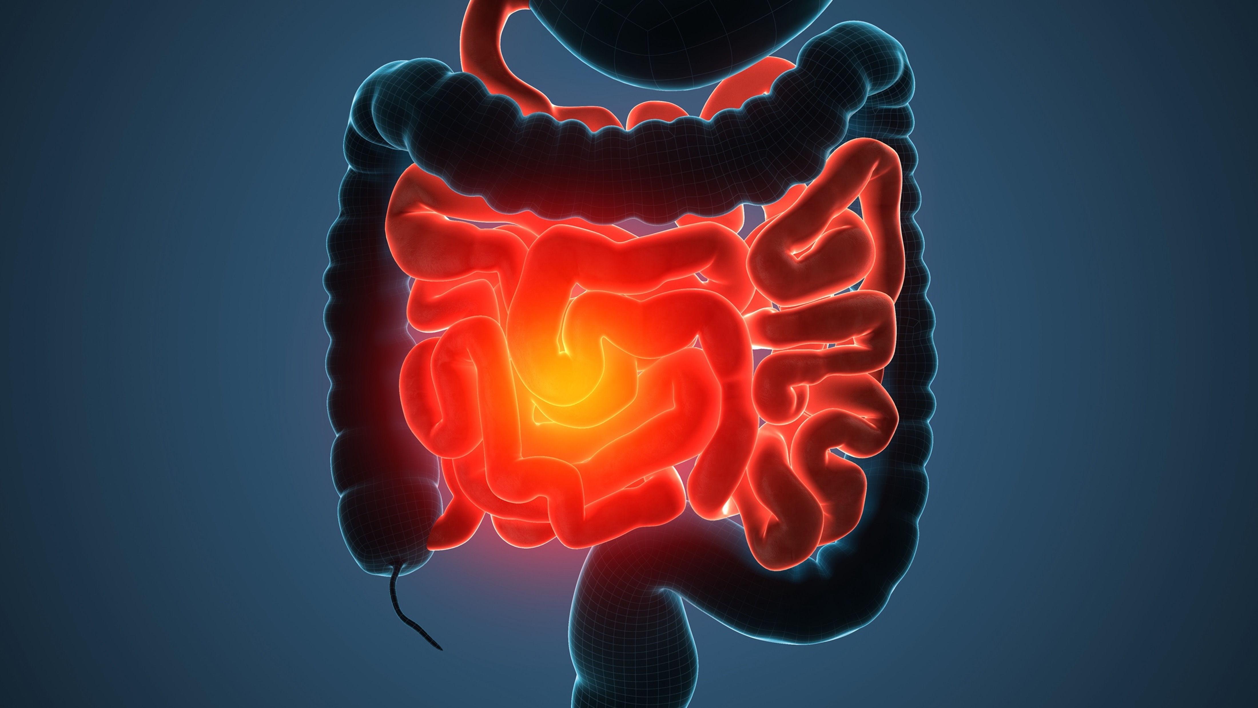 Cáncer colorrectal: FDA aprueba panel IHC para identificar dMMR y guiar inmunoterapia