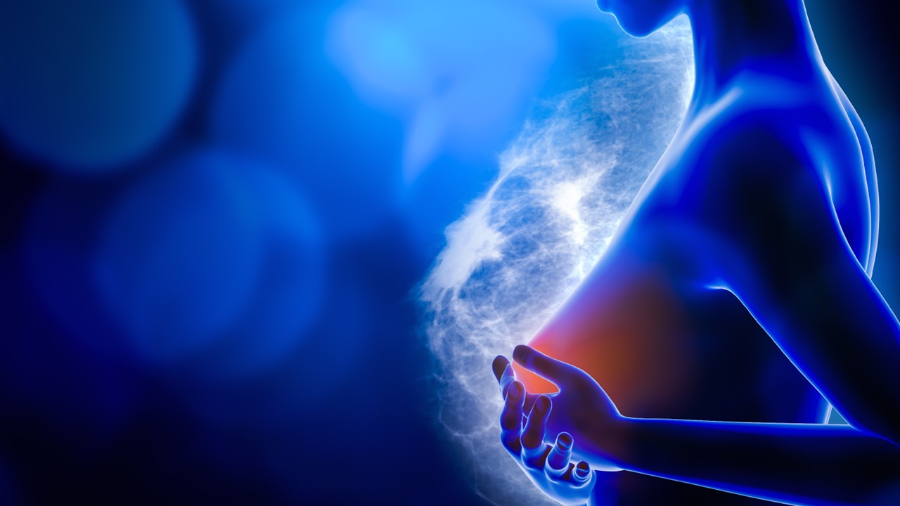 Cáncer de mama temprano RH+, HER2- de alto riesgo: abemaciclib más TE mejoran la SG en el estudio monarchE