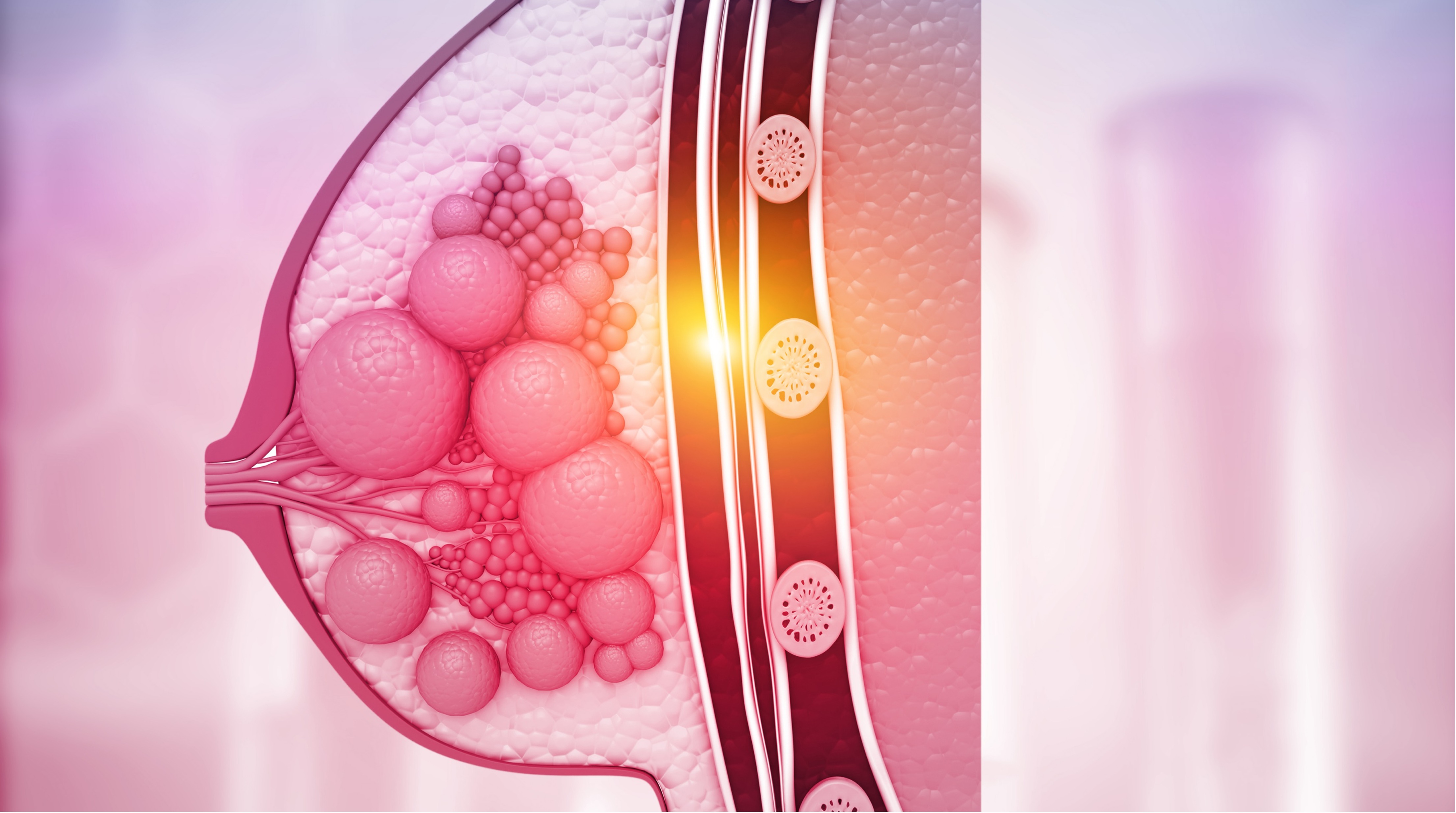 Cáncer de mama RH+/HER2– operable: sin beneficio añadido con palbociclib neoadyuvante