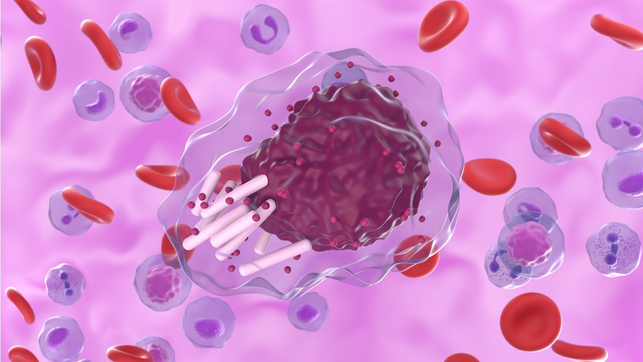 LLC/LLP: zanubrutinib muestra superioridad en SLP frente a venetoclax + obinutuzumab