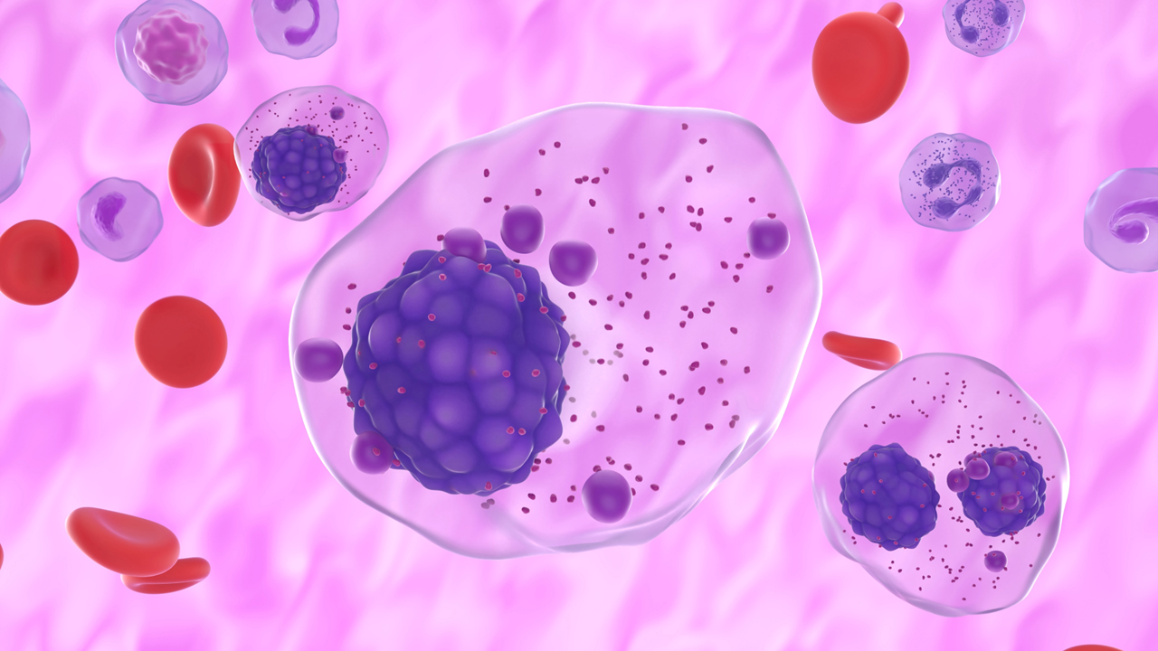 MM recién diagnosticados con negatividad en EMR: D-VRd muestran mejores resultados reportados por los pacientes y menor toxicidad, estudios PERSEUS y CEPHEUS