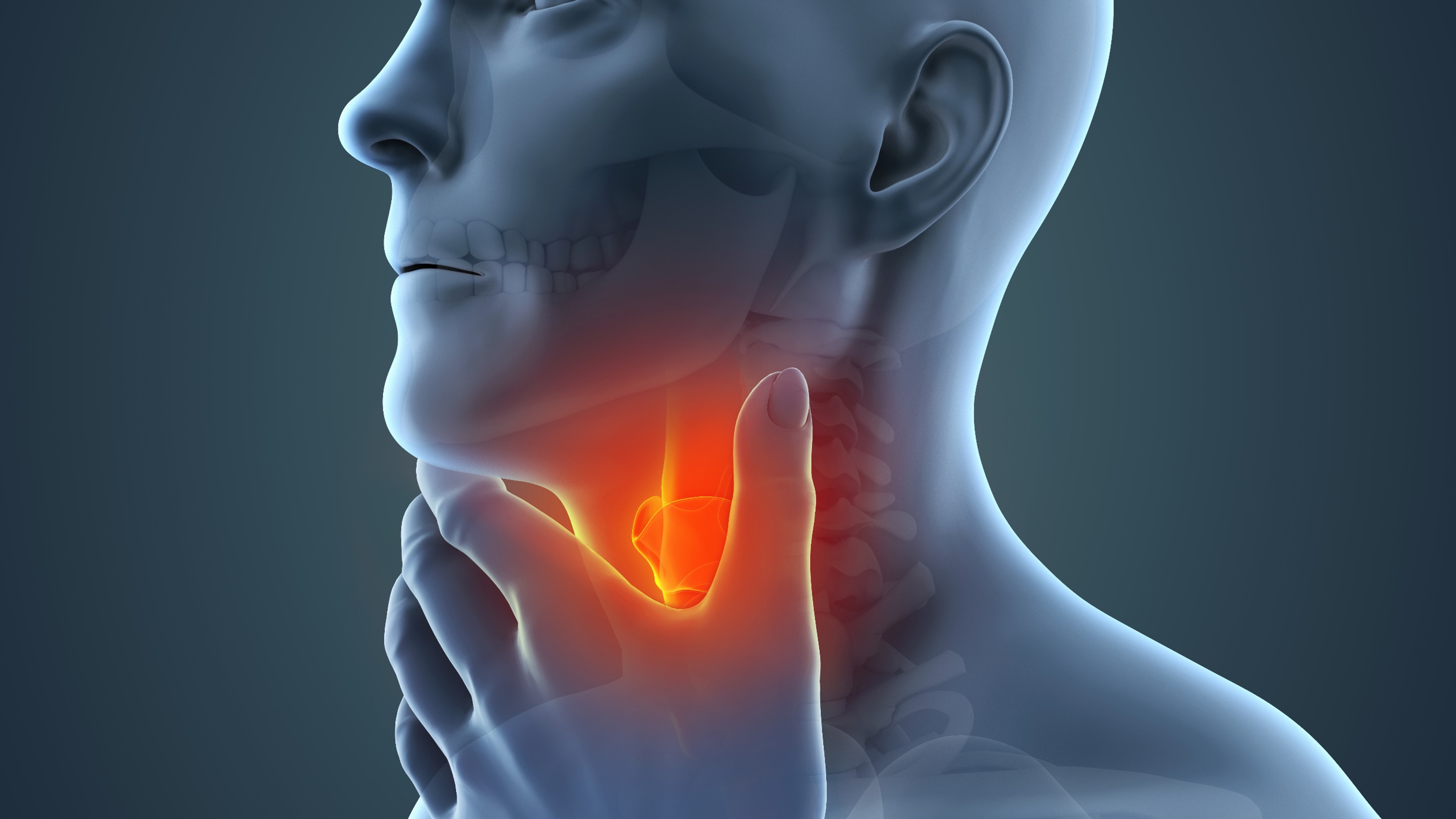 Cáncer escamoso de cabeza y cuello no resecado: xevinapant no mejora la supervivencia y aumenta la toxicidad, estudio TrilynX