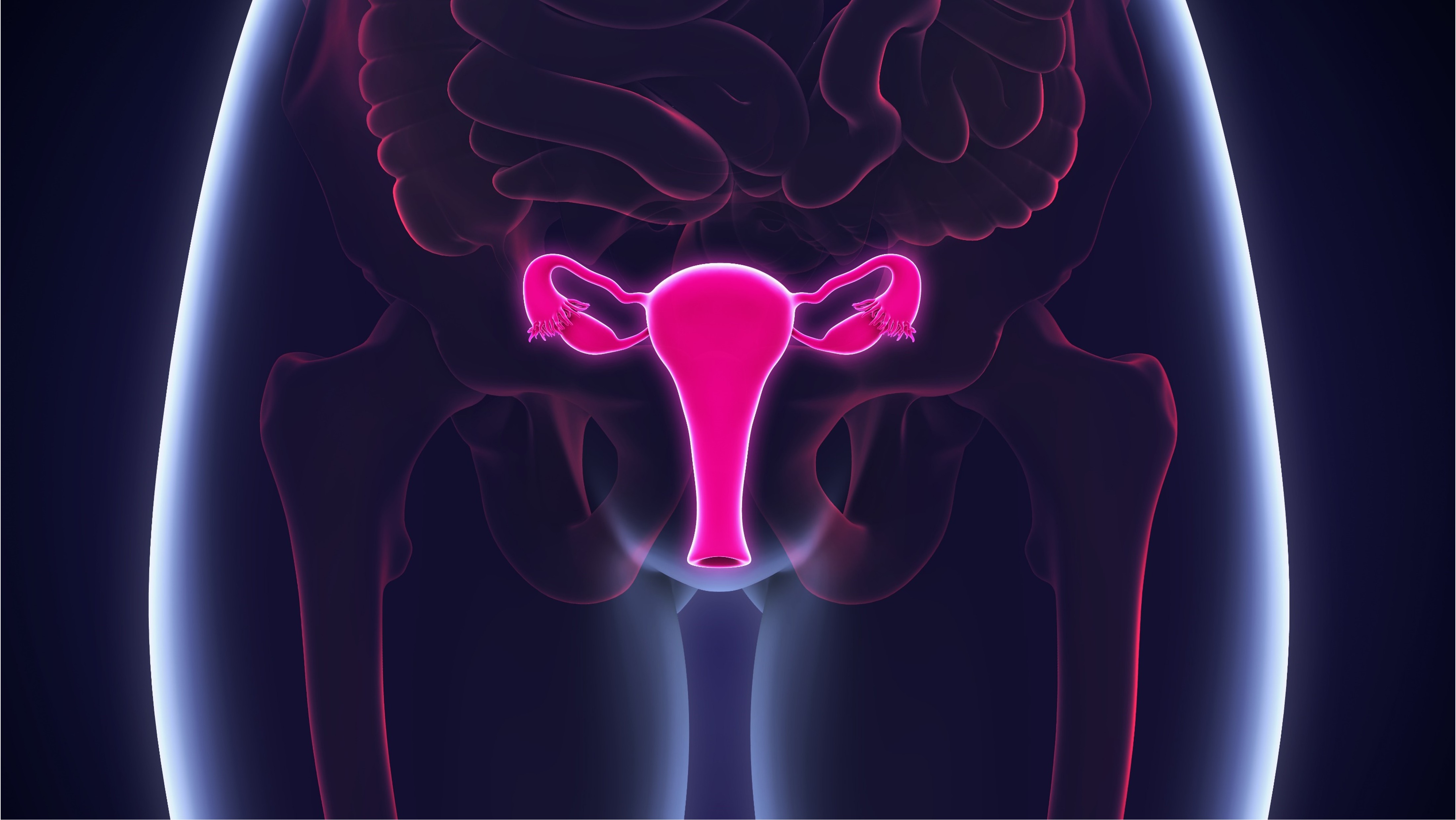 Cáncer de endometrio de alto riesgo: quimiorradioterapia mejora supervivencia, especialmente en tumores p53 anormales, estudio PORTEC-3