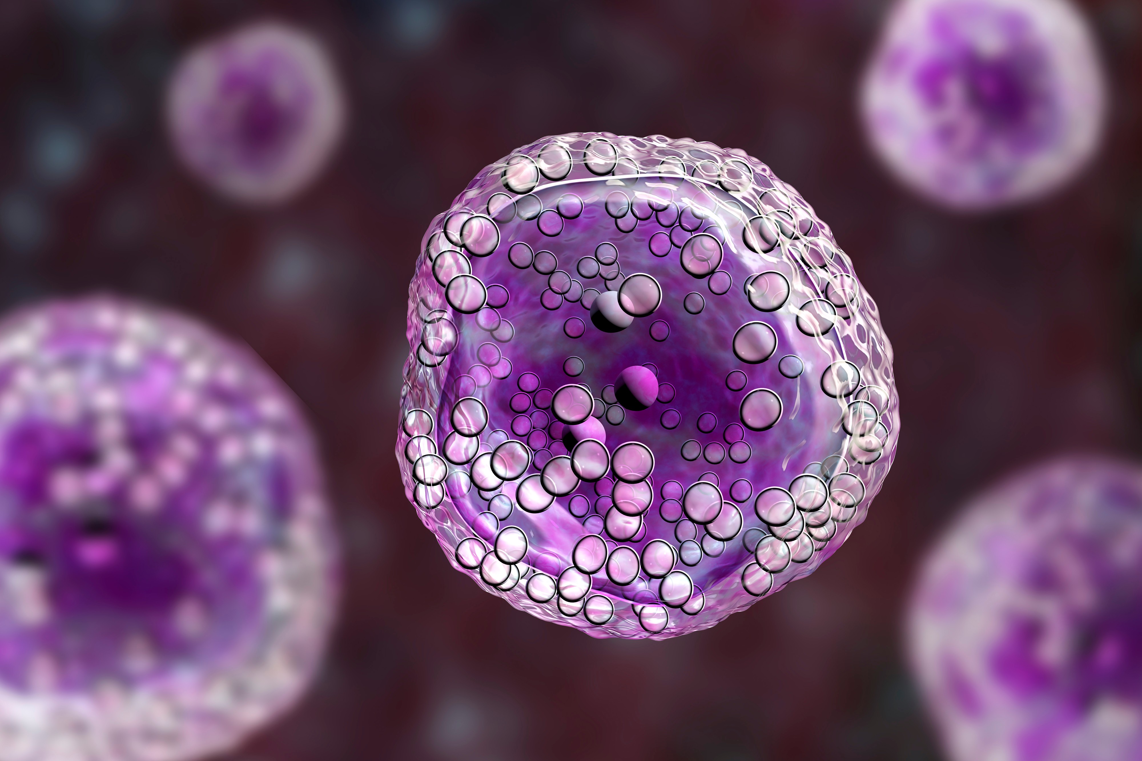 Linfoma de células B grandes R/R: mosunetuzumab + polatuzumab vedotin demuestran resultados positivos en eficacia, seguridad y mejoras en calidad de vida, estudio SUNMO