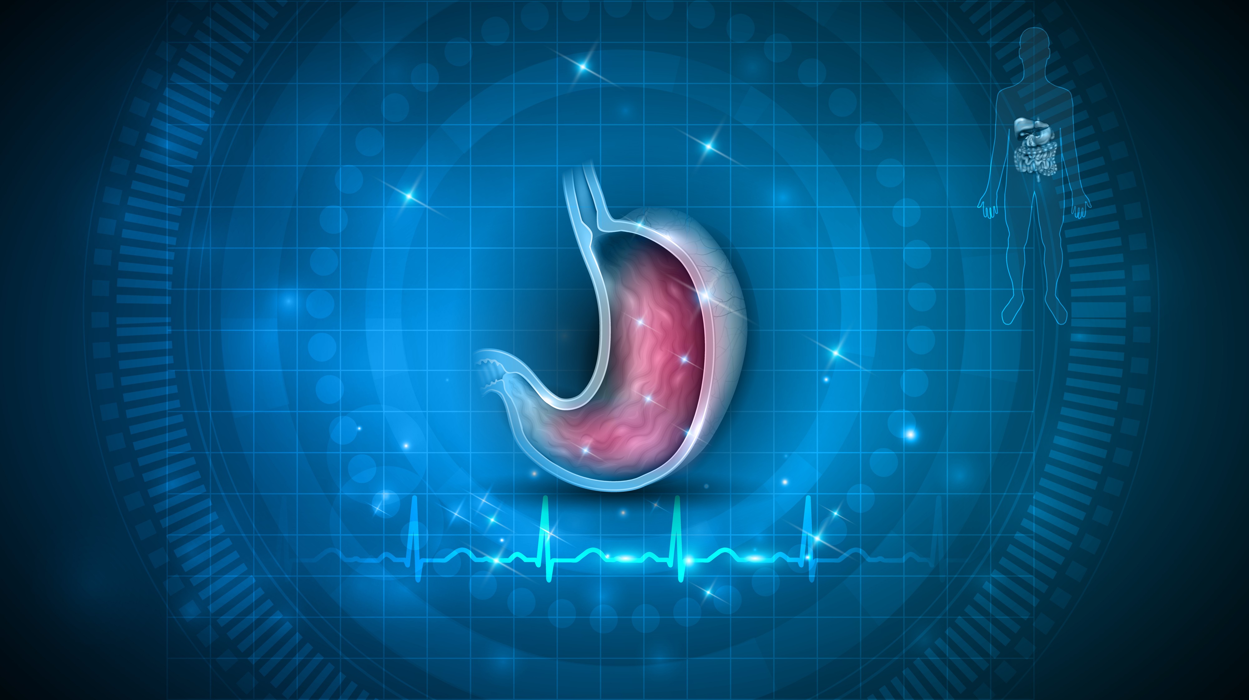 Tumores estromales gastrointestinales resistentes o intolerantes a imatinib: la combinación de bezuclastinib + sunitinib mejoró significativamente la SLP y la TRO, estudio PEAK