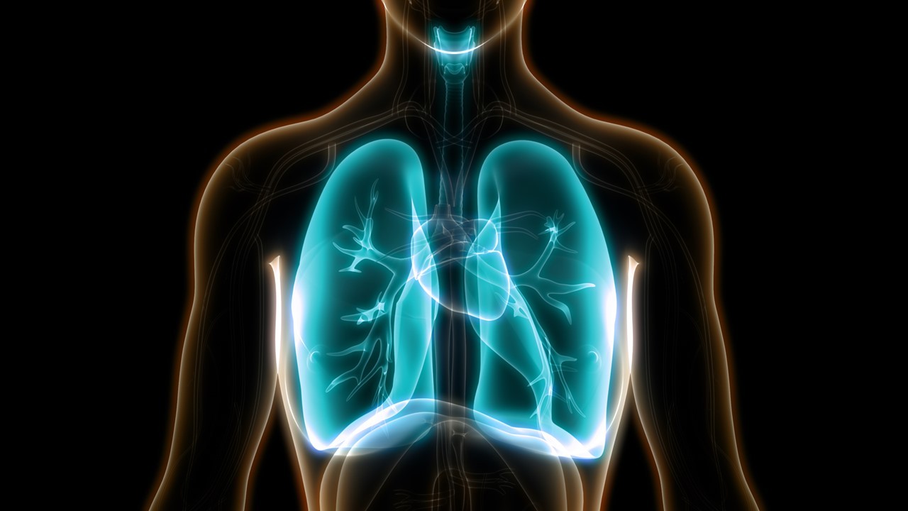 CPCNP: durvalumab con quimiorradioterapia basada en platino no mejoró la eficacia ni la seguridad, estudio PACIFIC-2