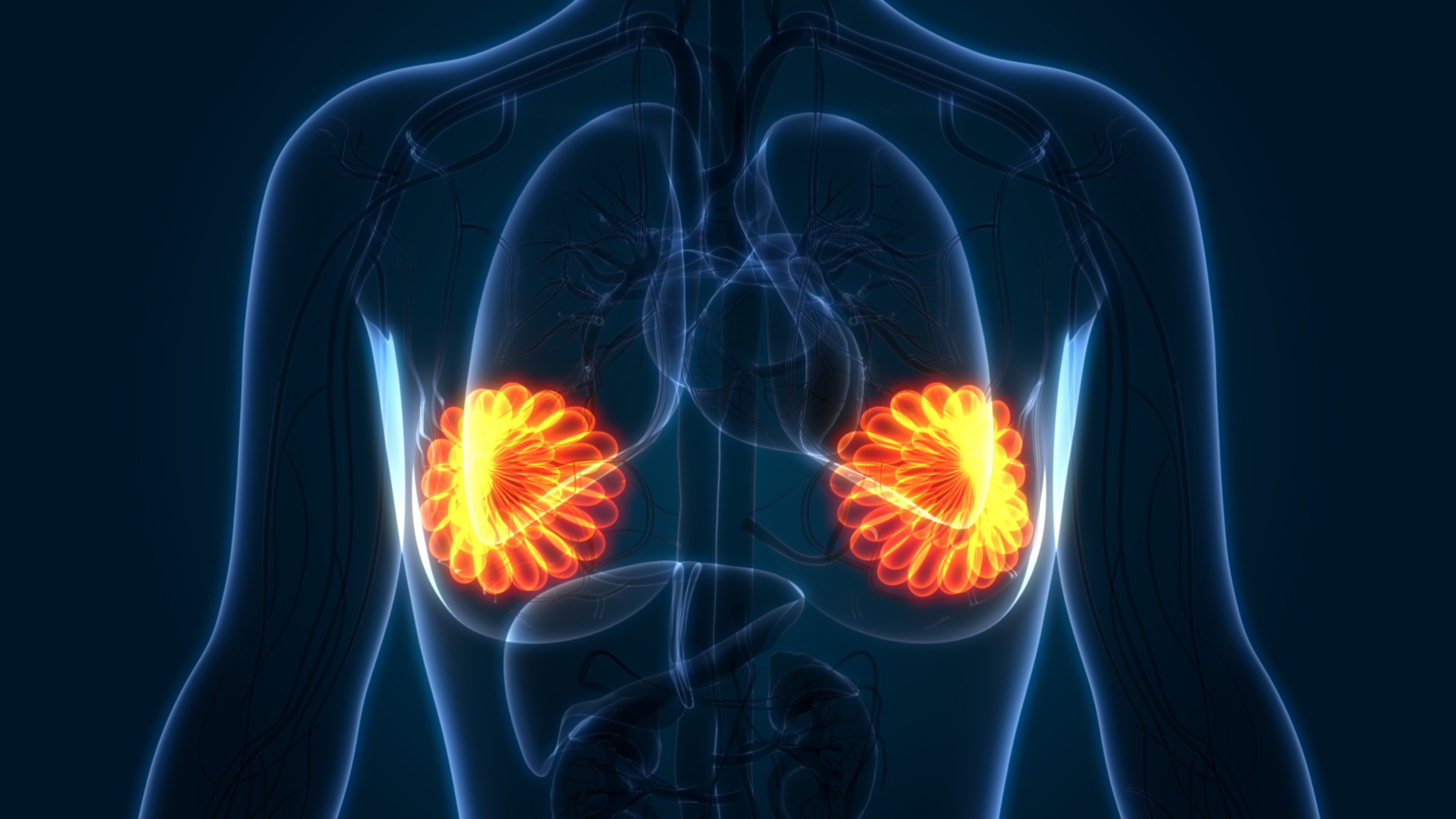 Cáncer de mama: fam-trastuzumab deruxtecan más pertuzumab reciben aprobación de la FDA para enfermedad HER2+ avanzada, estudio DESTINY-Breast09