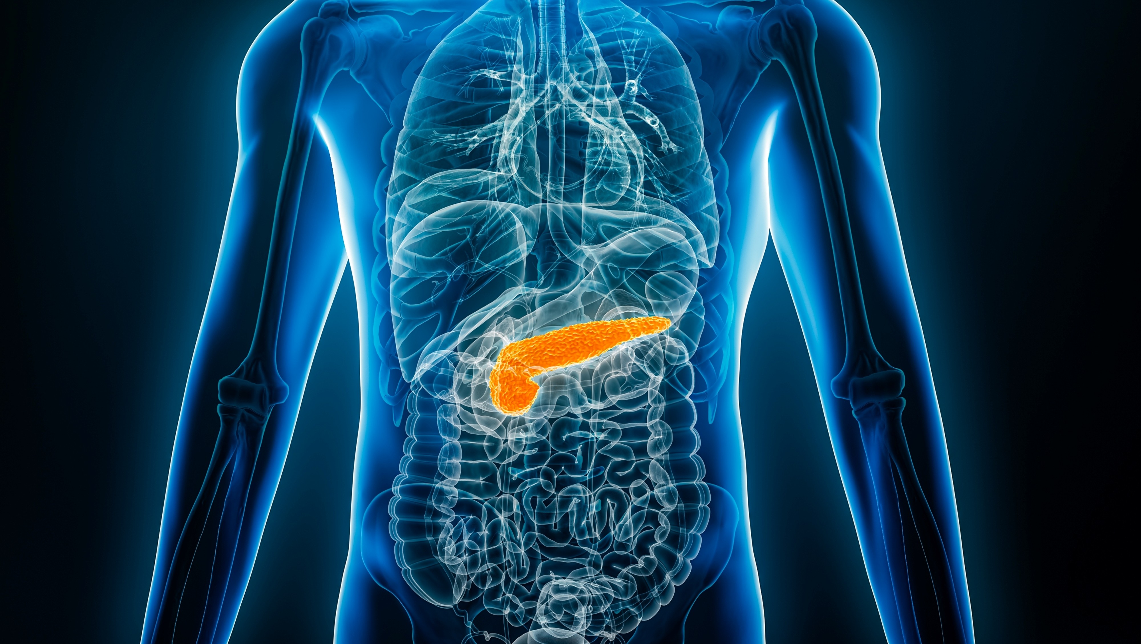 Cáncer de páncreas avanzado: TTFields aprobados por la FDA, ¿nuevo paradigma terapéutico?