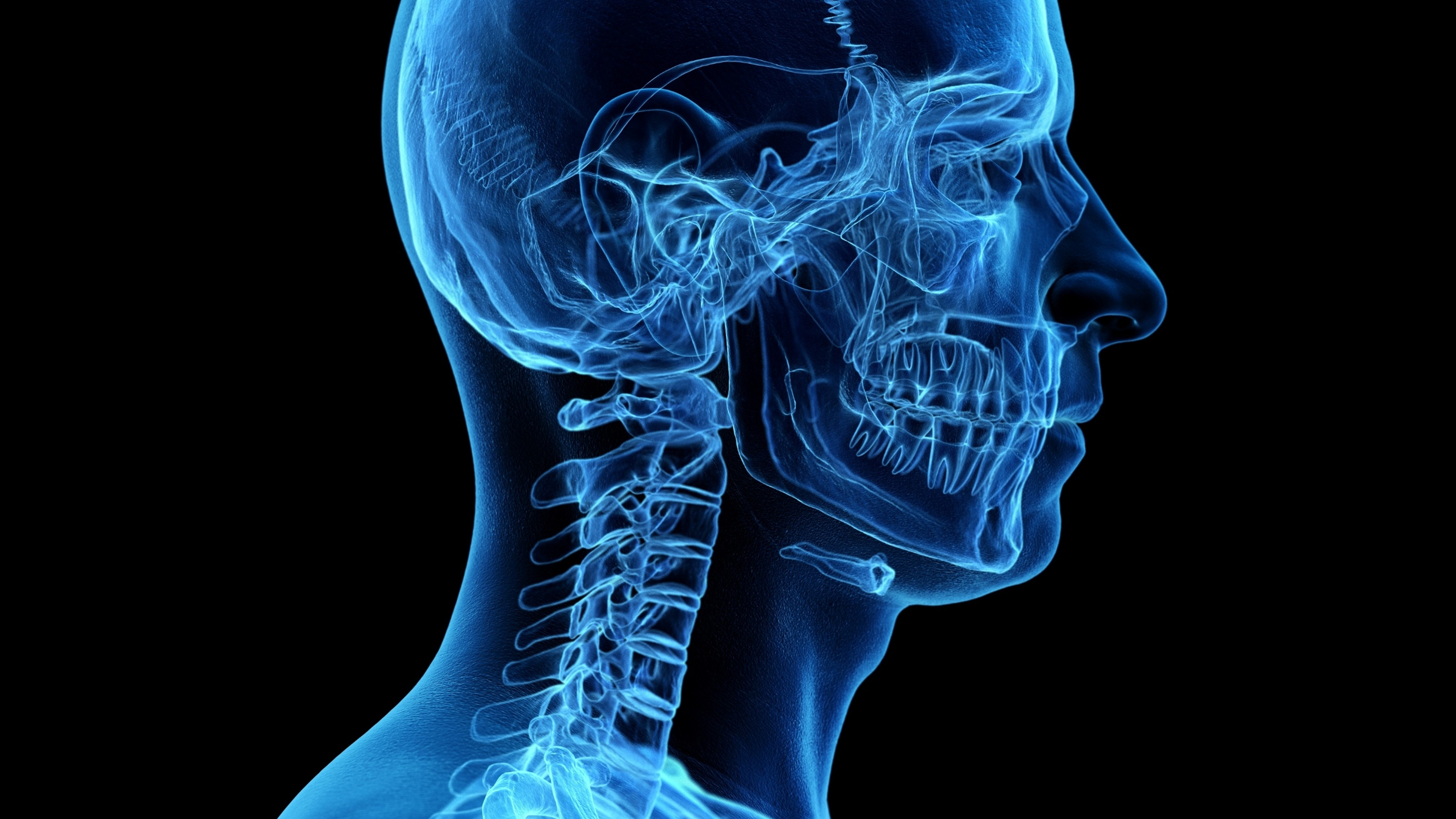 ¿Intensificar IO en carcinoma escamoso de cabeza y cuello? Lenvatinib no mejora SG, estudio LEAP-010