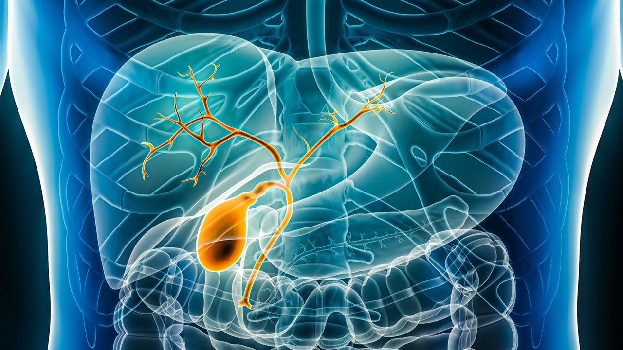 Tovecimig más paclitaxel como segunda línea en cáncer de vía biliar avanzado: COMPANION-002