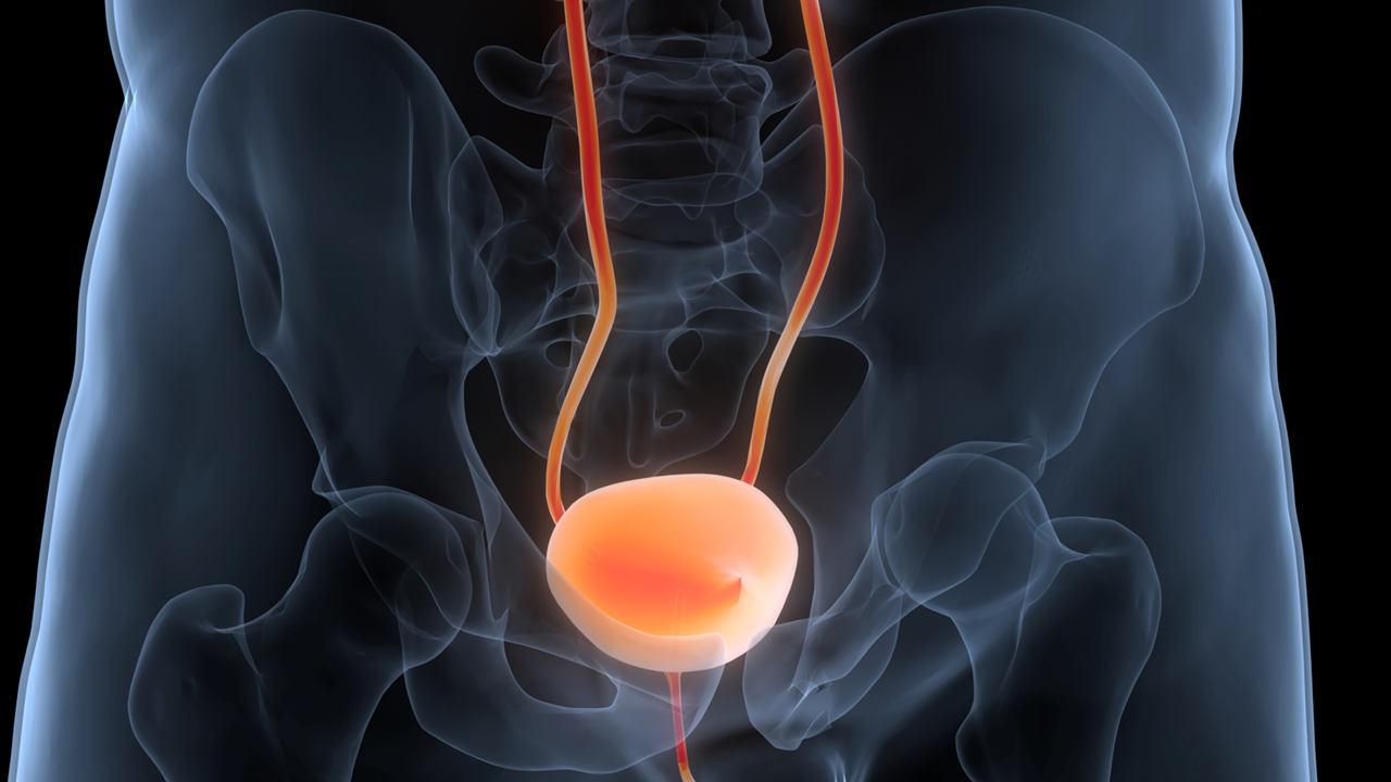 Resultados del estudio fase II DISCUS: ¿Es suficiente la inducción con tres ciclos antes del mantenimiento con avelumab?