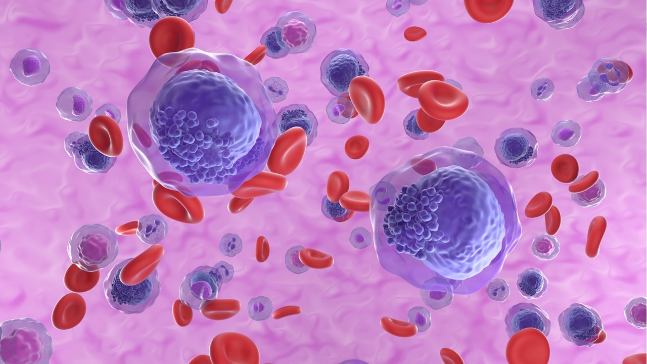 La FDA aprueba la combinación oral de decitabina y cedazuridina con venetoclax para LMA