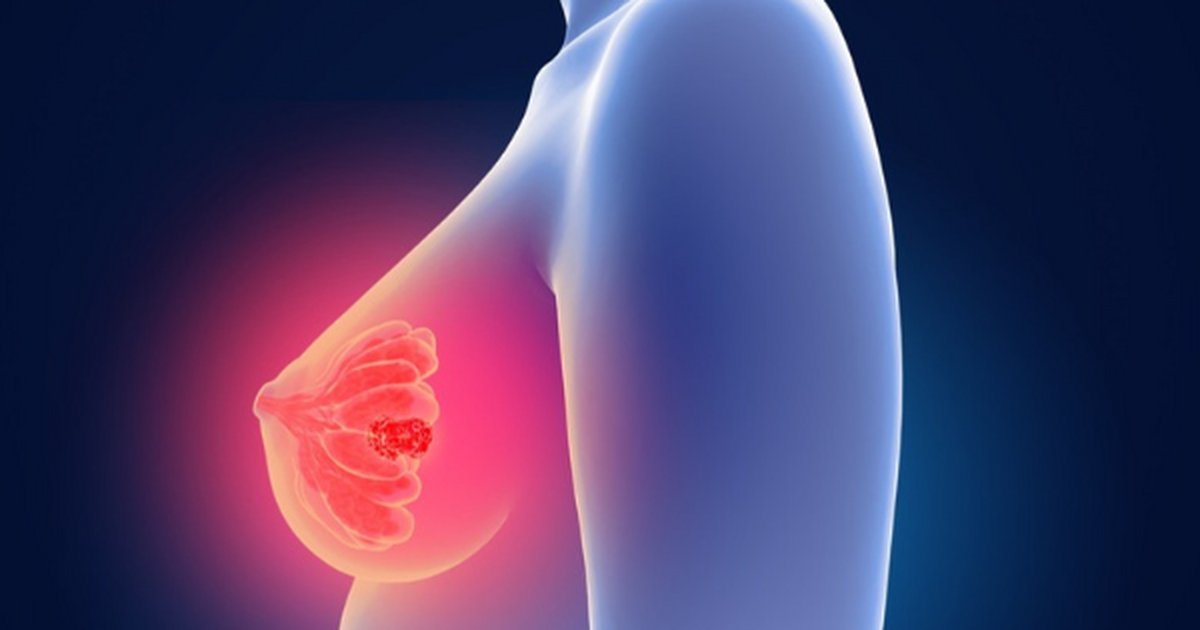 Se aprueba en Europa sacituzumab govitecán más pembrolizumab como primera línea en CMTN metastásico PD-L1 positivo