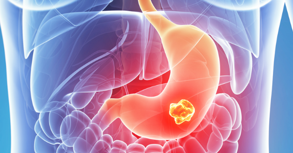 La FDA aprueba zanidatamab y tislelizumab para el tratamiento del adenocarcinoma gástrico, esofágico y de la UGE HER2 positivo