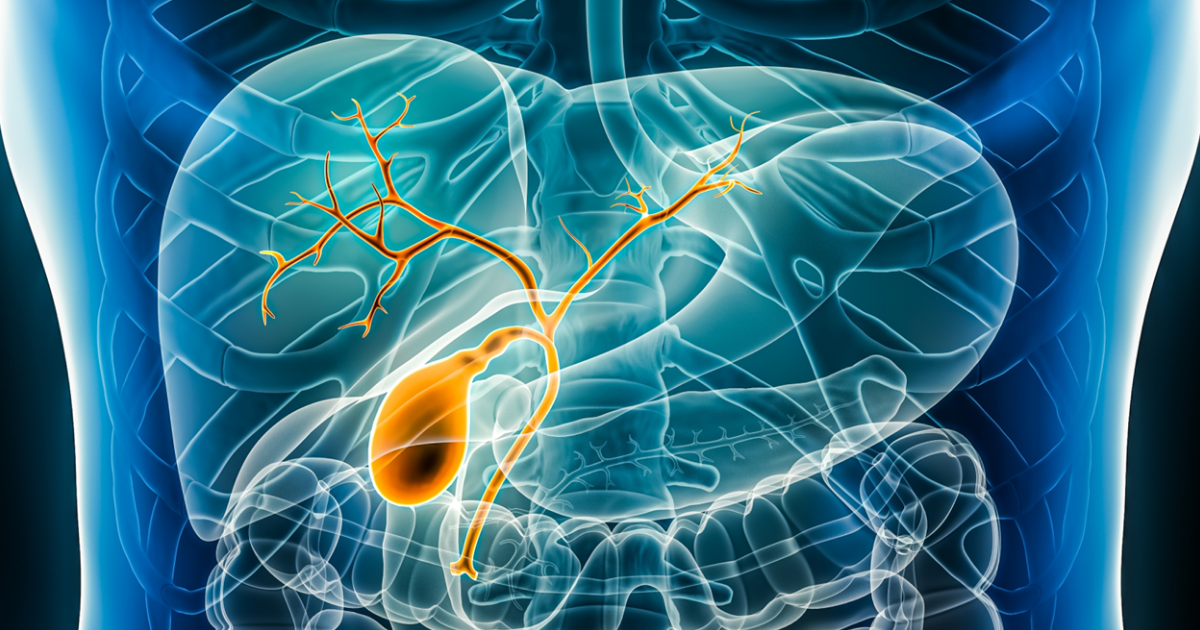 Ivonescimab más quimioterapia mejora la supervivencia global frente a durvalumab en cáncer de vía biliar